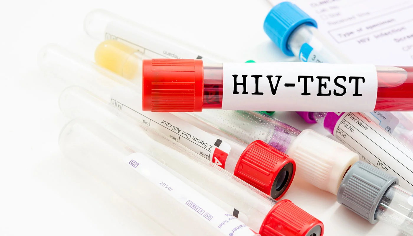 HIV Test Dubai